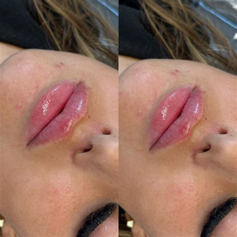 House Of All Aesthetics | Blyth