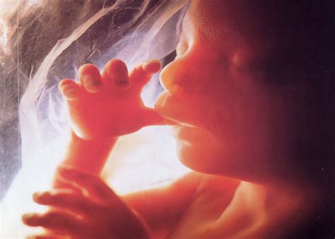 Mother pays $25,000 to kill her 8-month-old disabled baby - Live Action ...
