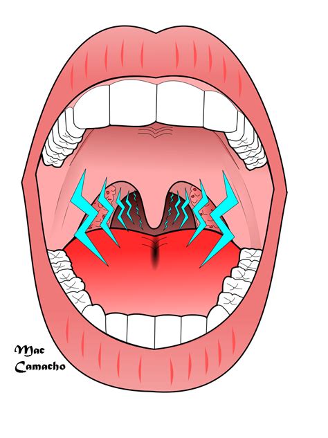 Рисунок горло (43 фото)