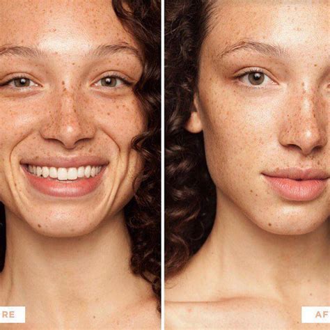 glycolic acid peels