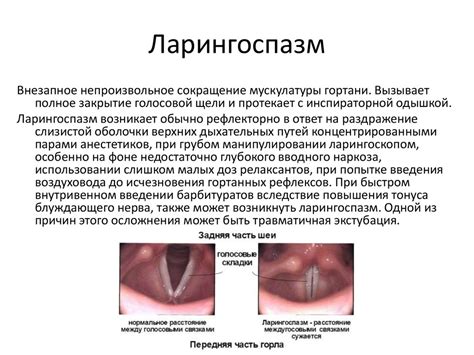 Опасности и осложнения анестезии у детей - презентация онлайн