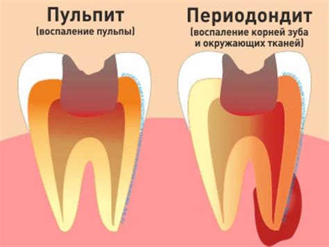 Флюс Зуба Фото — Картинки фотографии