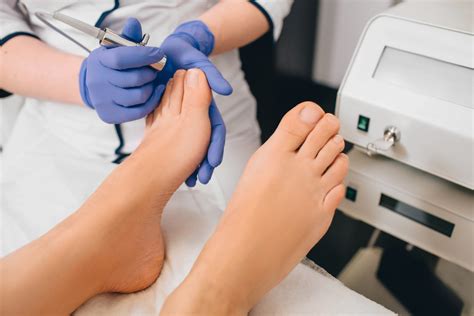 Laser Treatments for Toenail Fungus - Foot and Ankle Centers