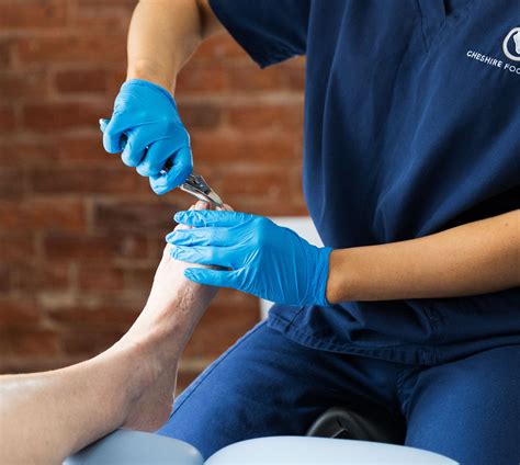 Hard Skin: Corns and Callus - Cheshire Foot Clinic