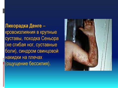 Геморрагические лихорадки - презентация онлайн