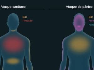 Sintomas De Mal Súbito - Mal súbito: o que é, causas, sintomas e como agir quando problema acontece