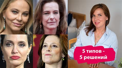 5 типов носогубных складок - можно убрать или нет?