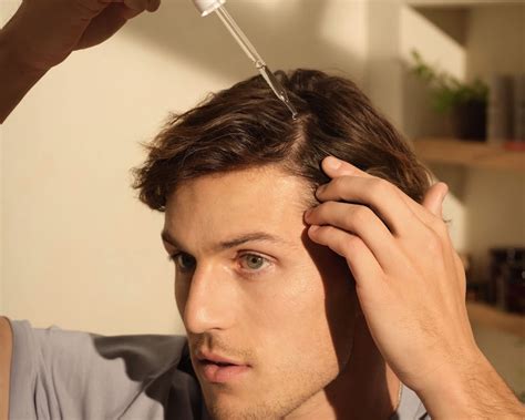 how to tell if your hair is thinning male