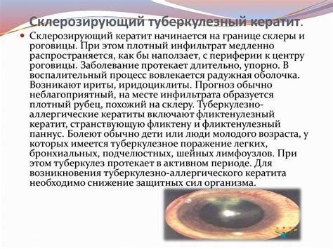Эндогенные кератиты - презентация онлайн