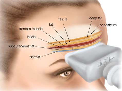 academy anatomy forehead cutaneous