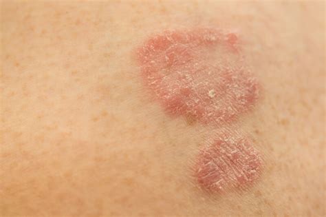 Are Allergies Causing Your Skin Sensitivity? - Vibrance MedSpa
