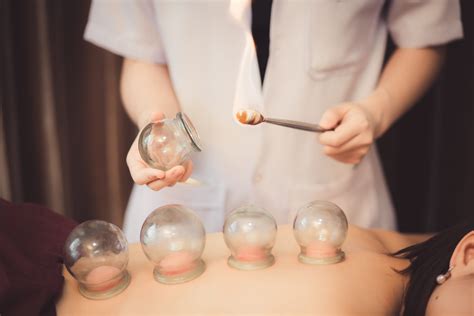What are the Benefits of Using Cupping? - SOHMA Integrative Medicine