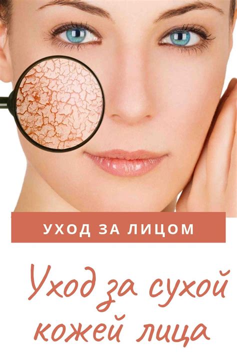 Уход за сухой кожей лица | Сухая кожа лица, Лицо, Лечение прыщей