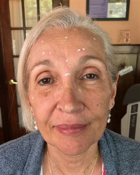 Your Best You Medical Spa - Medical Aesthetics, Health & Wellness