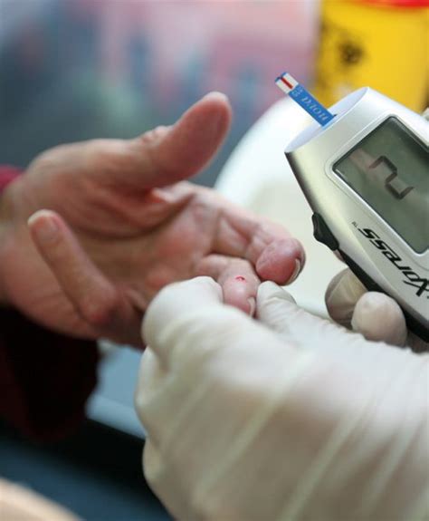 Endocrinologie - Diabétologie - Nutrition - CH DOUAI