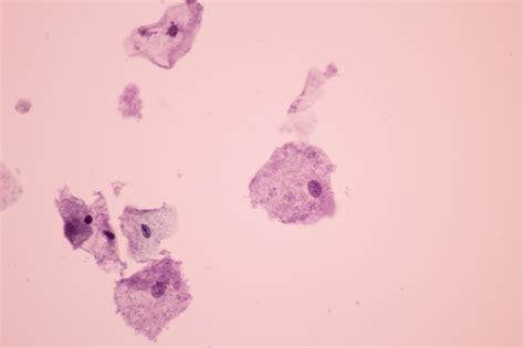 La vaginose bactérienne, c'est quoi ? - Mag Adam et Eve