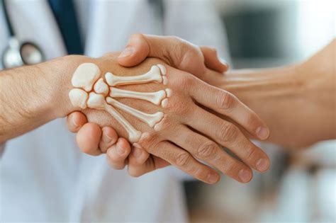 rheumatology essvee multi speciality hospital