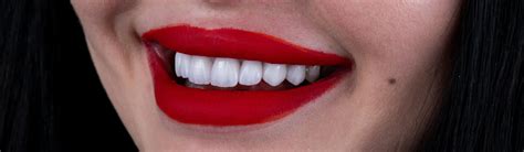 DENTAL EMAX VENEERS VS. ZIRCONIUM CROWNS: An In-Depth Comparison for ...
