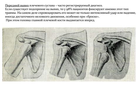 Анатомическое строение плечевого сустава - презентация онлайн