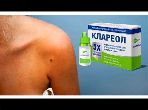 Клареол Лекарство _От Папиллом Отзывы - YouTube
