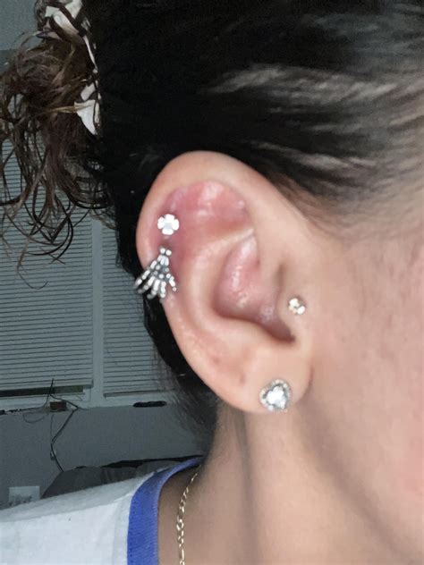 piercing shop ruined my ear. 1st pic is when i left and 2nd pic is now