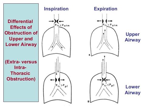 1 hypoventilation disorders