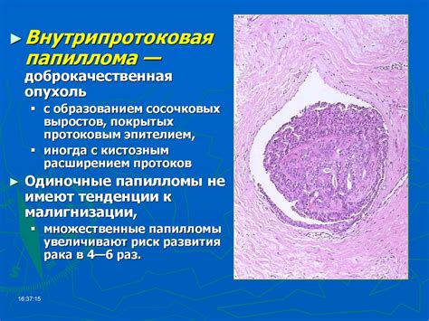 Болезни женских половых органов, молочной железы и заболевания ...