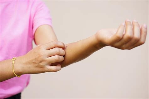 Premium Photo | Woman itchy arm