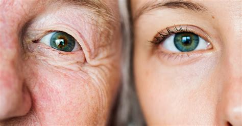 Rare eye diseases