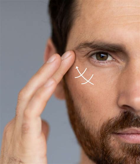 pdo thread lift  london    surgical facelift dr sheila