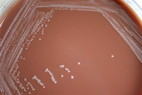 Free picture: colonial, morphology, gram, negative, brucella abortus ...