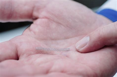 Coronary Stent - Heart Center 2016 (1) - Lakeland Regional Health