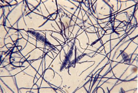 perform  fungal culture