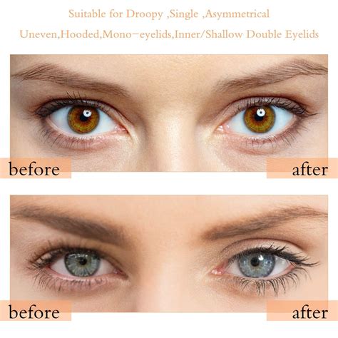 how to tighten eyelids at home 7