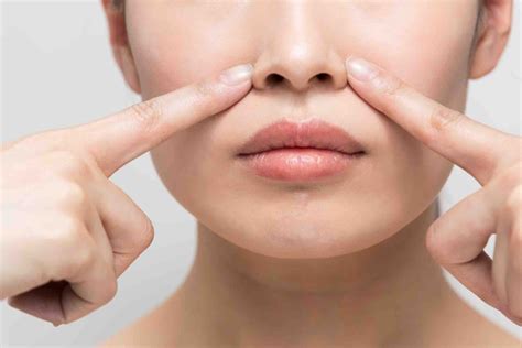 wide nose smaller dr mark doyle