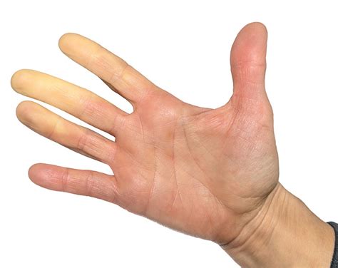 Dermatologia Clínica - Dra. Priscilla Ortiz