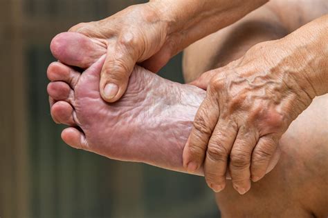 What to Do About Diabetic Feet Swelling - Foot & Ankle Clinics of Arizona