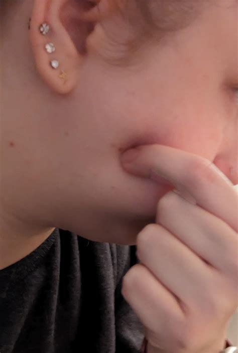 hard movable lump? have on other side but much smaller. this is my bad