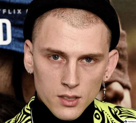 Machine Gun Kelly Hair Transplant: FUT or FUE?