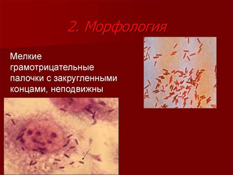 Возбудители бактериальных кишечных инфекций - презентация онлайн