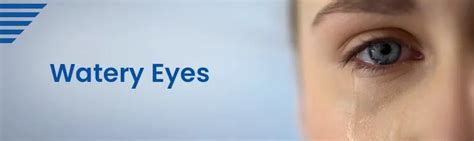 Watery Eyes (Epiphora) : Symptoms, Causes, Treatments & Precautions