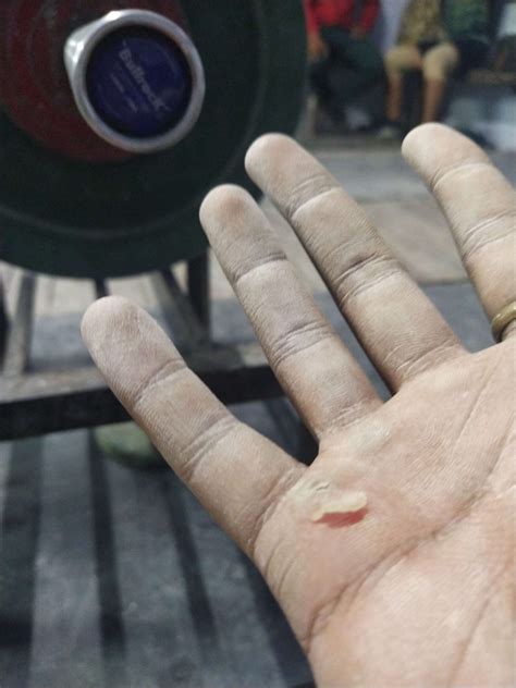 How to stop calluses on hands from gym? - MENSQUATS