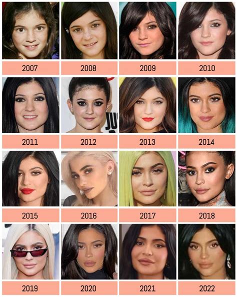 Kylie Jenner Before and After ? All of her Plastic Surgery!