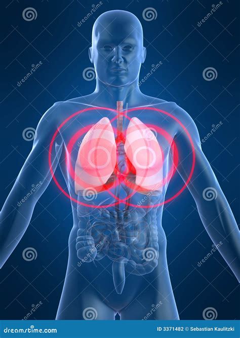 Liver inflammation stock illustration. Illustration of liver - 3371482
