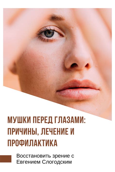 Пин на доске гимнастика для глаз