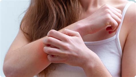 Top 4 Solutions to Itchy Bug Bites – Zax's Original