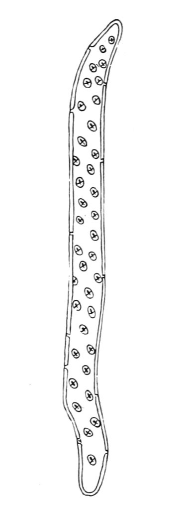 Difference Between Tracheids and Vessels | Definition, Characteristics ...