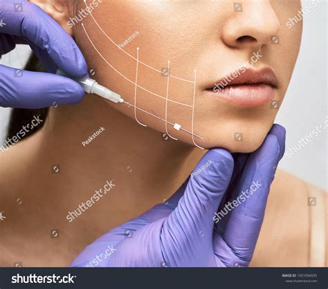 face lift thread images stock  vectors shutterstock
