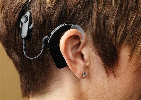 heard  cochlear woroni