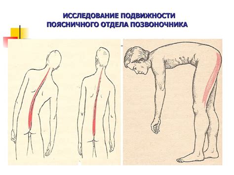 Боли в спине. Актуальность проблемы - презентация онлайн